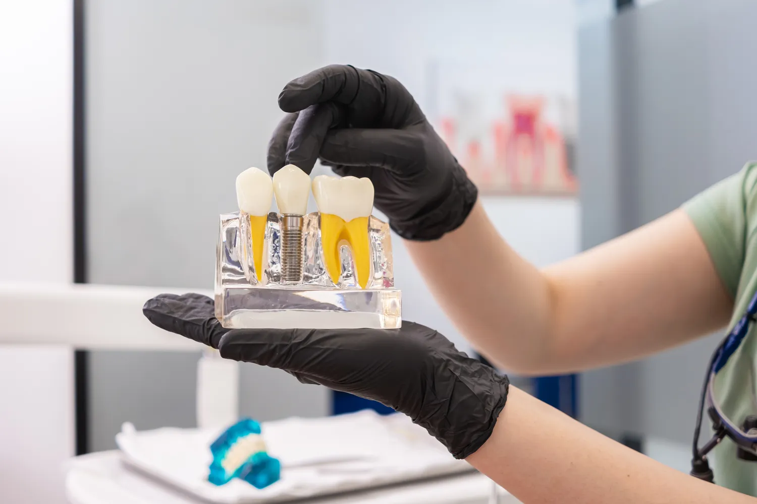 Implanty zębów cała szczęka Lublin