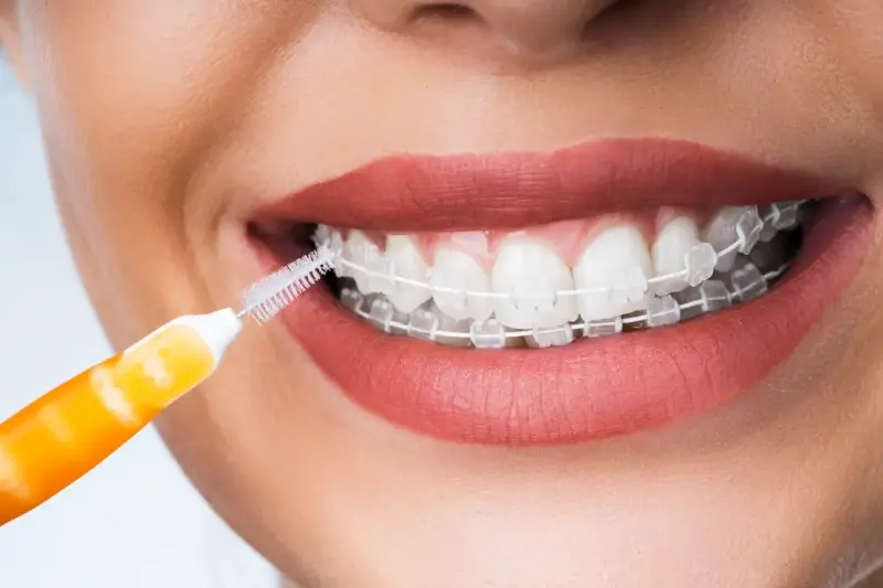 Najlepszy gabinet stomatologiczny Warszawa