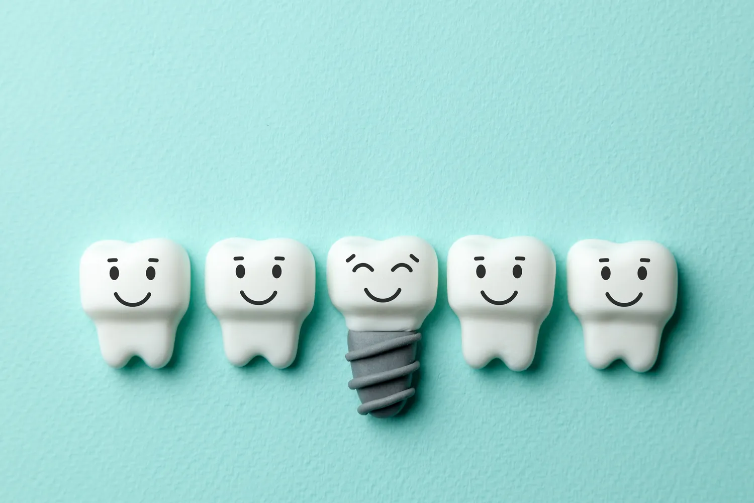 Etapy w implantologii w celu uzyskania efektu końcowego